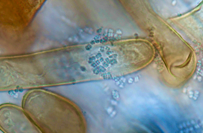 Endophytic bacteria in a root hair.